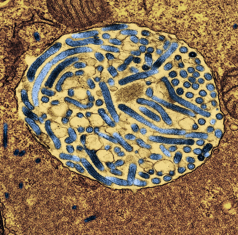 marburg virus latest news